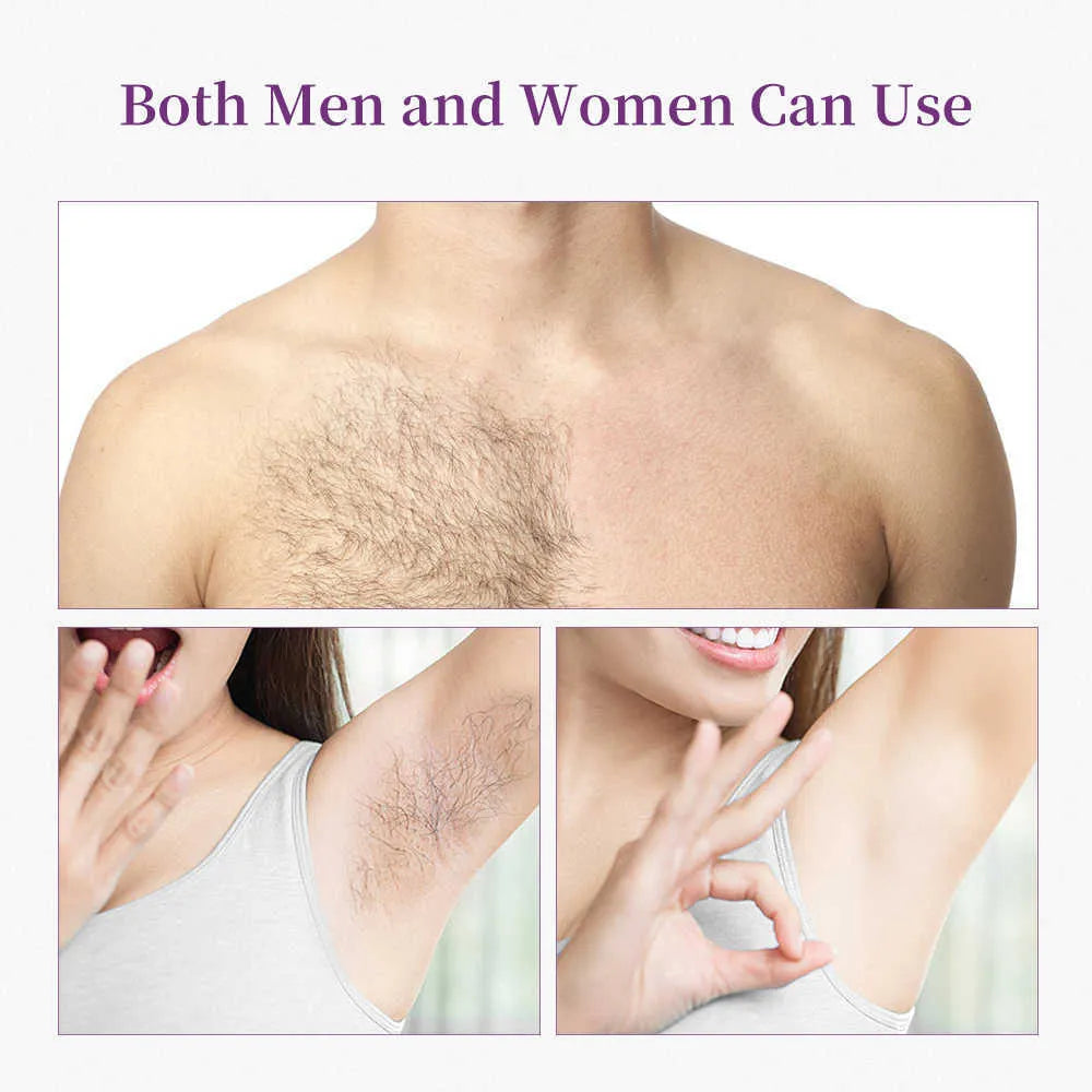 Permanent Hair Removal Machine